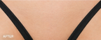 Hair Removal Soothing Essence Roller